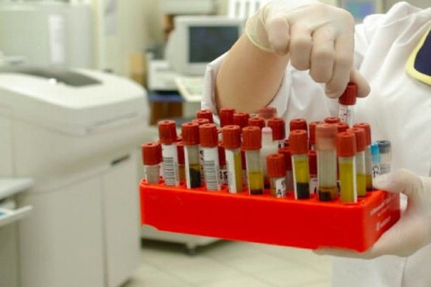 Outsourcing diagnostyki laboratoryjnej: jakość i cena - czy idą z sobą w parze?