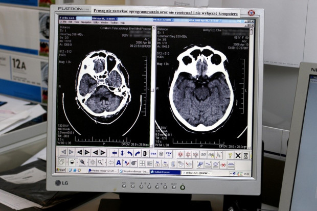 Włocławek: pracownia tomograficzna już działa