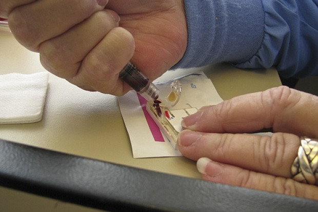 Testy alternatywą dla biopsji wątroby