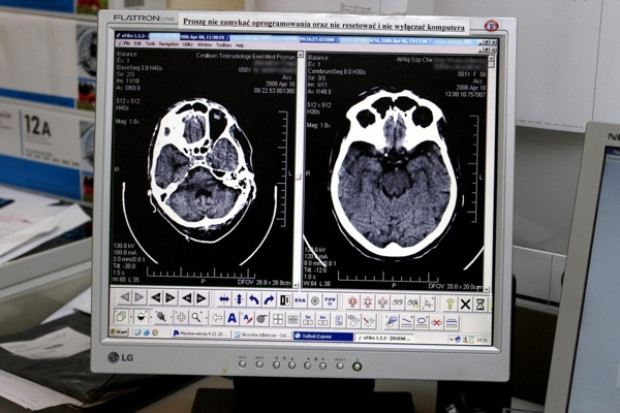 Lublin: ENEL-MED otrzymał kontrakt z NFZ na diagnostykę obrazową
