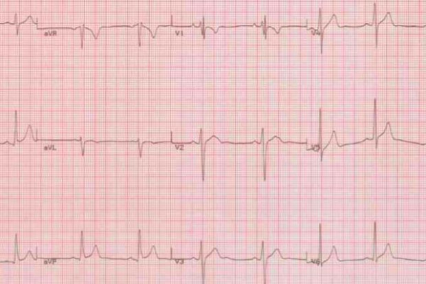 Puszczykowo: szpital chce kompleksowo leczyć chorych kardiologicznych