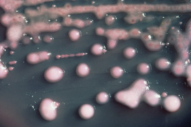 Kraków: klebsiella pneumoniae nie zagraża już pacjentom szpitala
