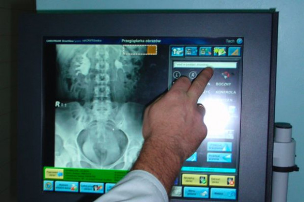 Siedlce: nowoczesna radiologia - klisze do lamusa