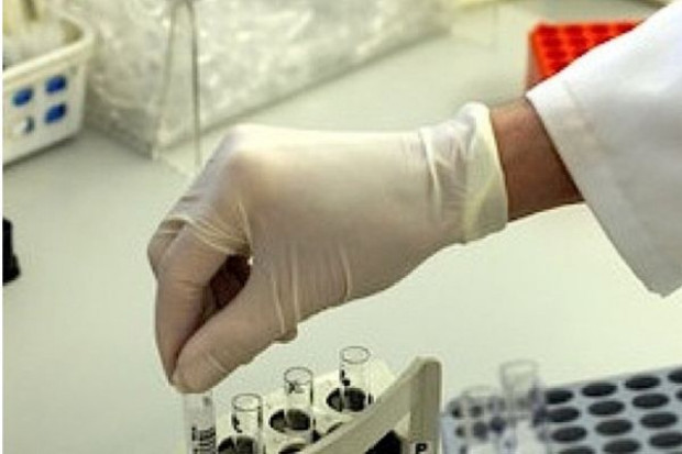 Naukowcy: zastrzyk przeciwciał obniża poziom cholesterolu LDL
