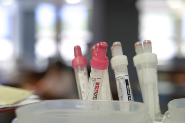 Test do przesiewowej oceny nieprawidłowej glikemii na czczo u osób w wieku dojrzewania