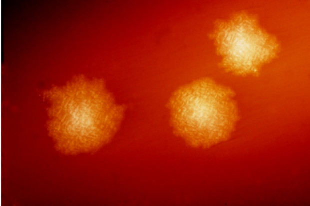 Rokowanie w zakażeniach Clostridium difficile u chorych z nieswoistym zapaleniem jelit
