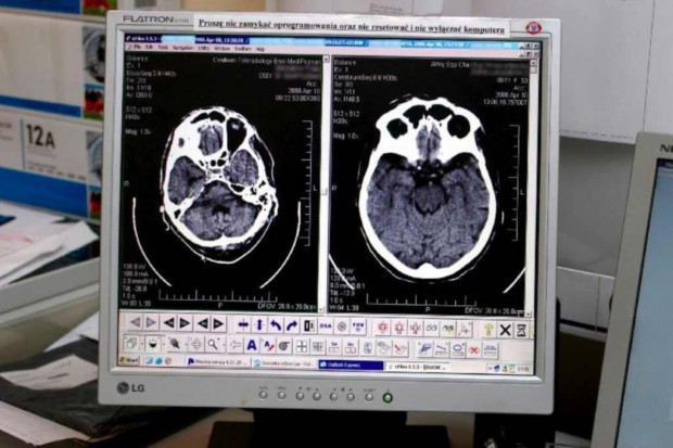 Badanie mózgu pozwoli na wczesną diagnozę dysleksji