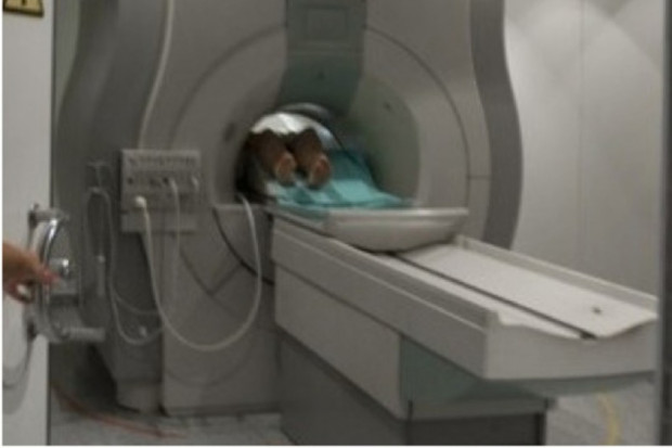 Rak płuca: potrzebna szybka diagnostyka i skrócenie czasu do rozpoczęcia leczenia