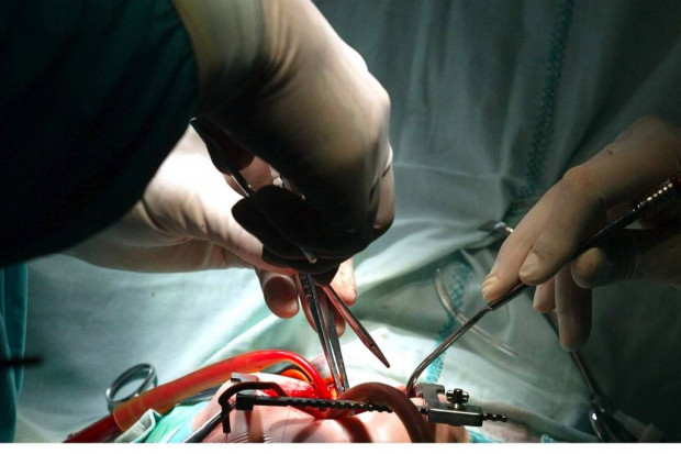 Szczecin: transplantologia wyszła na prostą