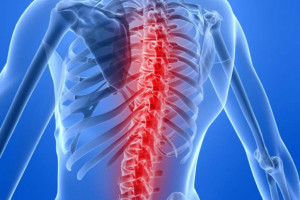 FOT. Fotolia; zdjęcie ilustracyjne Specjaliści: dolegliwości kręgosłupa to choroba cywilizacyjna