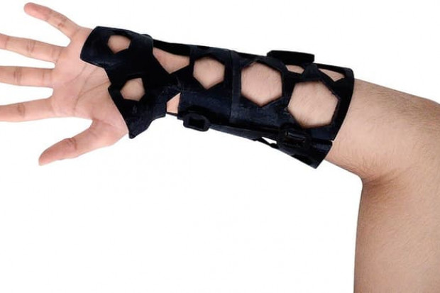 Rękawiczki drukowane w 3D mają zastąpić opatrunki gisowe. Fot. gizmag.com Drukowane rękawiczki zastąpią gips?