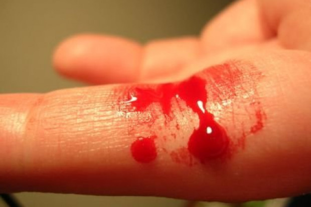 Jest projekt nowego programu zapobiegania krwawieniom u dzieci z hemofilią - oby teraz znalazły się pieniądze