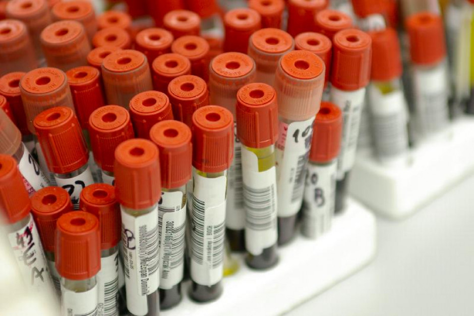 Jesień - sezon na badania laboratoryjne