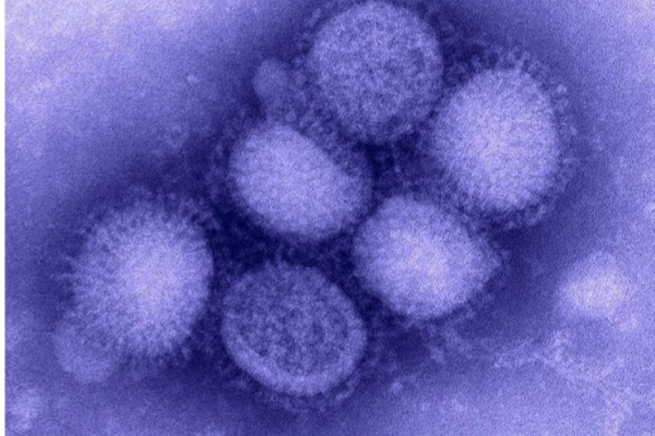 Gdańsk: rozpoczęto badania na obecność wirusa A/H1N1