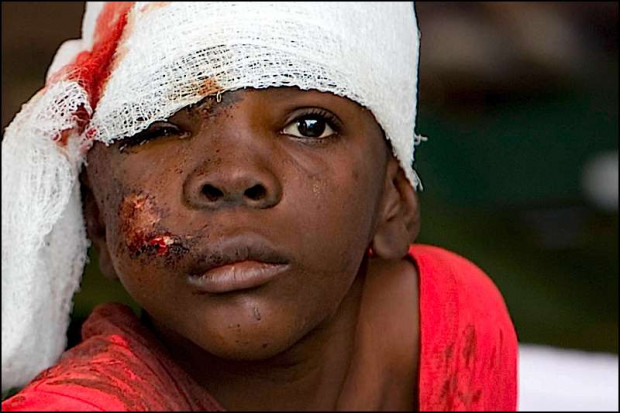 Haiti: Polacy na miejscu, lekarze nigdy nie widzieli tylu obrażeń