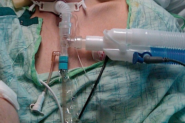 Trwa zamieszanie wokół opieki długoterminowej - nie każdy jej doczeka?