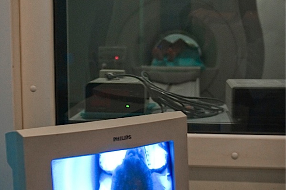 Gliwice: zostanie wdrożony system teleonkologii