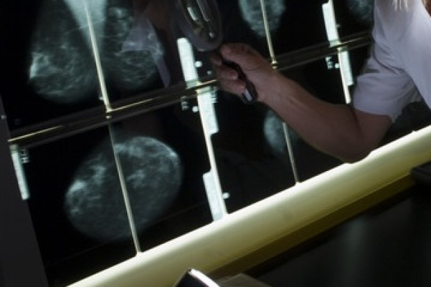 Petycja przeciwko obowiązkowej mammografii i cytologii