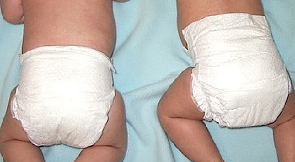 Bułgaria: 62-latka urodziła bliźniaki po in vitro