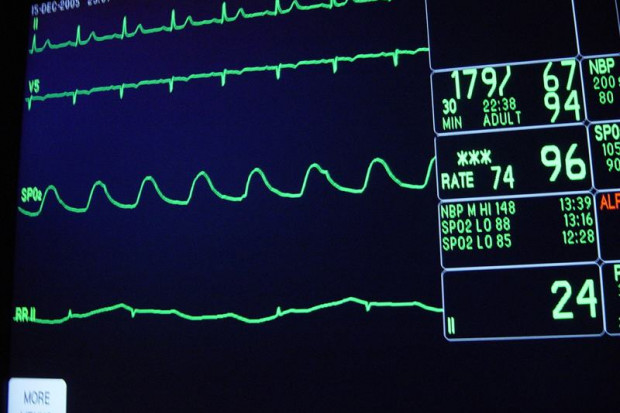 Chełmno: rozbudują nadzór kardiologiczny