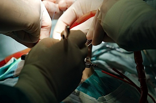 Białystok: transplantologia potrzebuje wsparcia