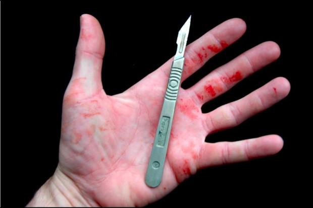 Zakopane: uczą się nowej metody diagnozowania raka