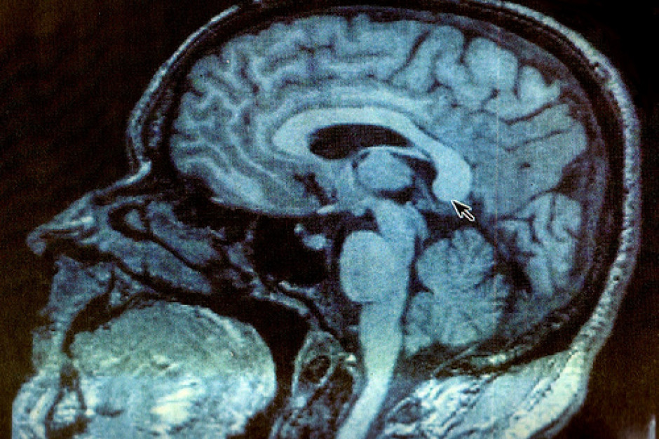 Opole: teraz większa izba przyjęć, potem zabiegi interwencji neuroradiologicznej