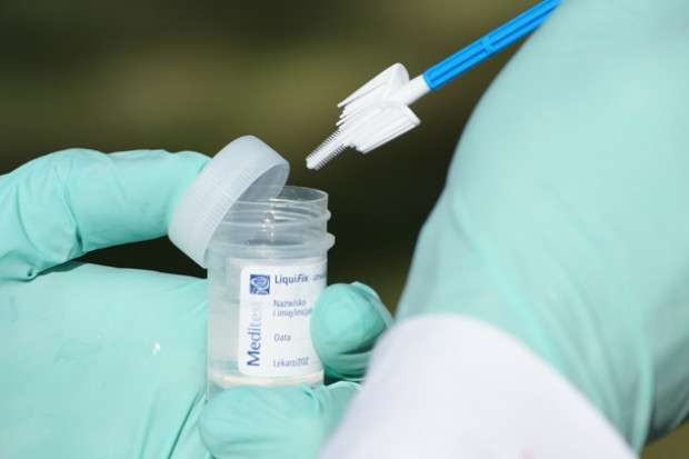 Olsztyn: co dalej z badaniami cytologicznymi i mammograficznymi?