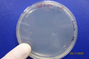Bakterie jelitowe mogą być przyczyną reumatyzmu