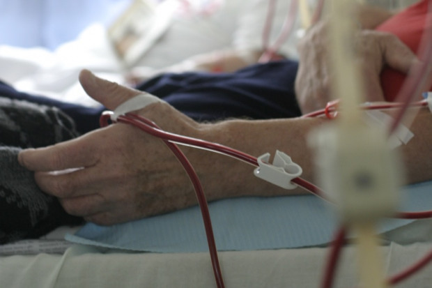 Kalisz: sprawa zakażeń żółtaczką typu C - wkrótce wyrok