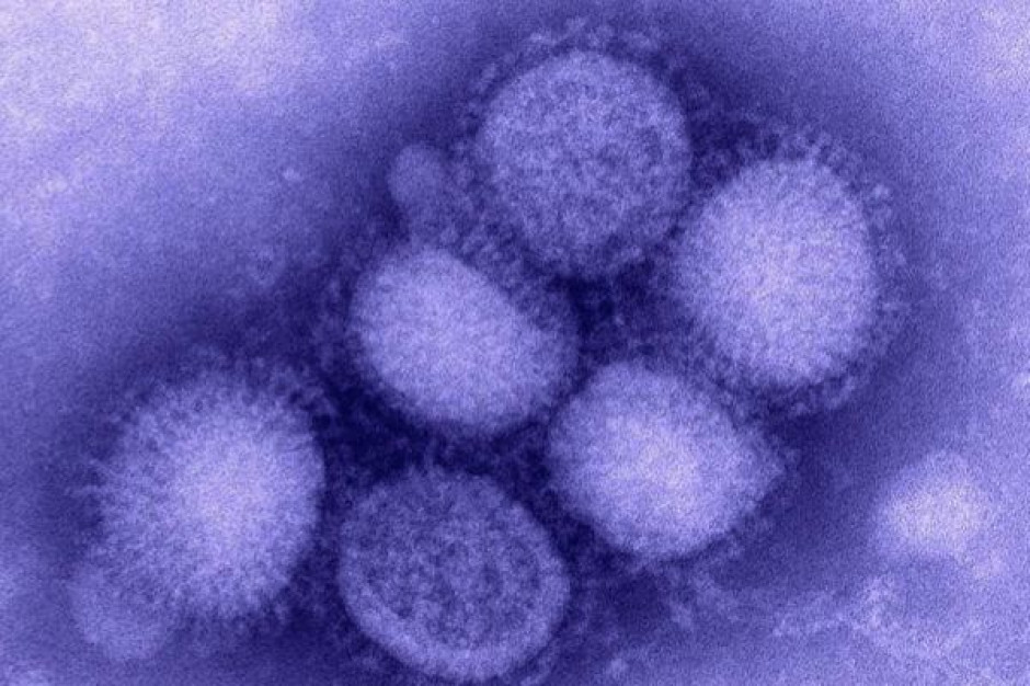 Lekarze uspokajają, że na razie nie ma mowy o epidemii zakażeń wirusem grypy A/H1N1. Fot. Archiwum Pomorskie: jest 16 przypadek zakażenia wirusem grypy A/H1N1, ale to nie...