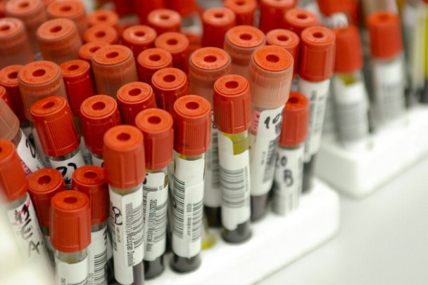 Przejęcia na rynku diagnostyki laboratoryjnej