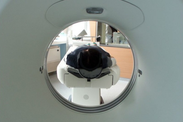 Czy trądzik różowaty wymaga diagnozowania tomografem?