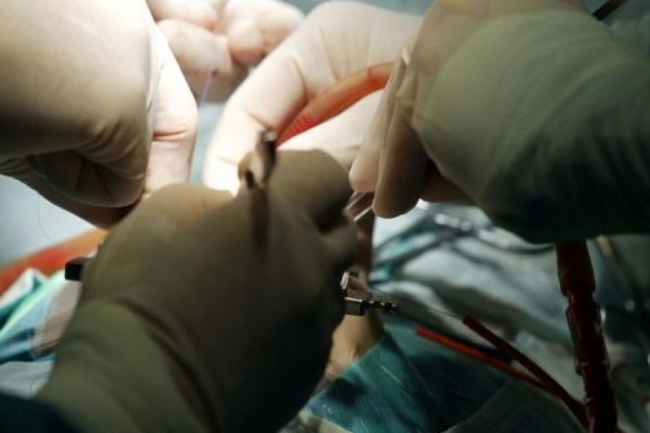 Na krytycznym etapie operacji zespół lekarzy czasowo pozbawiony jest dziś kluczowego narzędzia monitorującego pracę serca, jakim jest zapis EKG. Fot. PTWP Polacy pracują nad nowym EKG z powierzchni bijącego serca