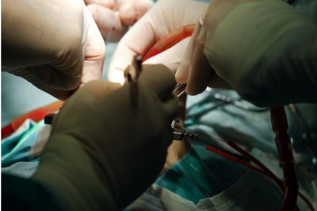 Warszawa: rusza kampania promująca akcję Partnerstwo dla Transplantacji