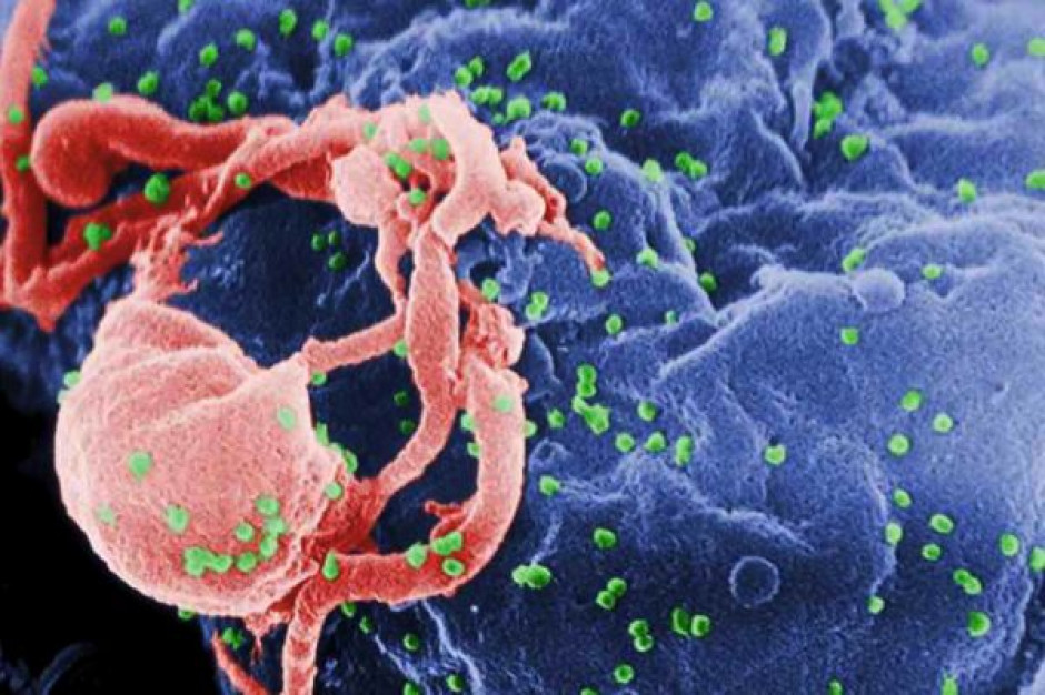 Wirus HIV. Fot. archiwum Klinika omyłkowo ujawniła dane pacjentów z HIV