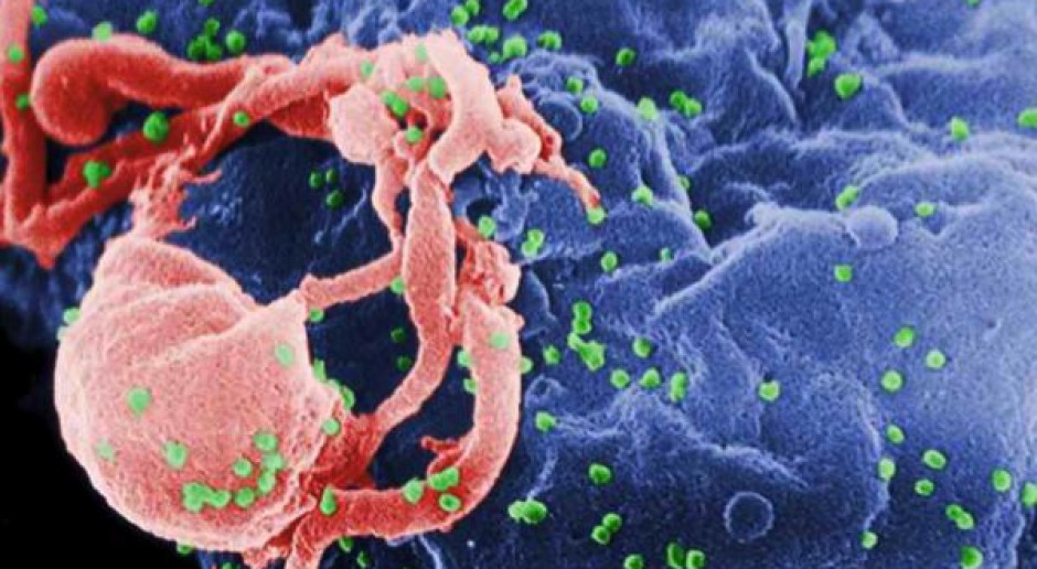 Spadła liczba zachorowań na AIDS na świecie 