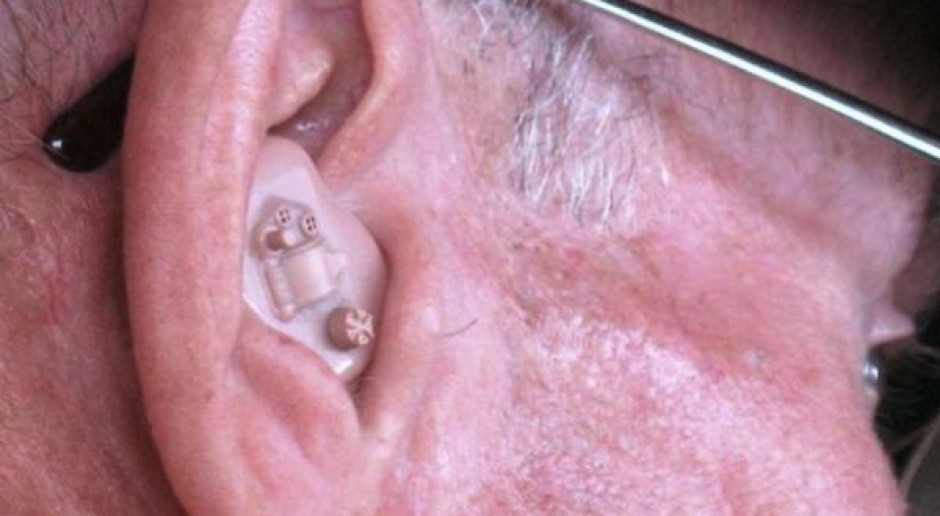 PSPS: spada liczba refundacji aparatów słuchowych 