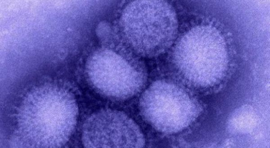 Małopolskie: 24 przypadki zachorowań na świńską grypę