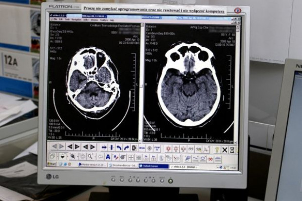 Białystok: szpital MSWiA ma tomograf komputerowy