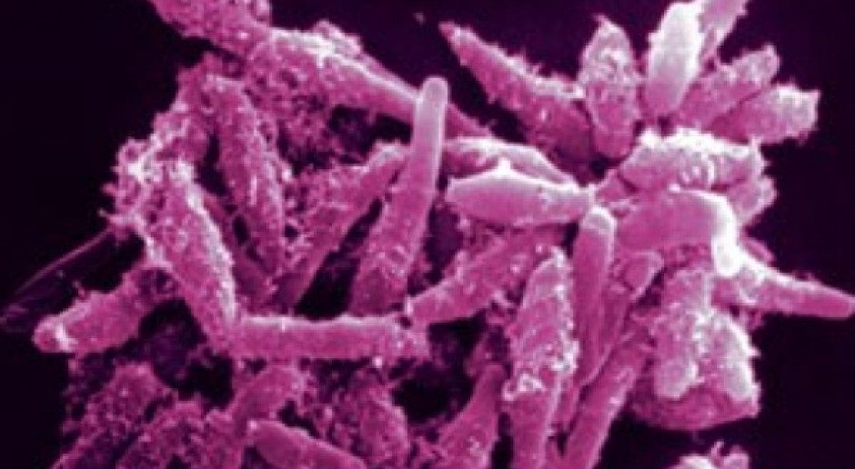 Warszawa: powstaje aparat do wykrywania bakterii opornych na antybiotyki