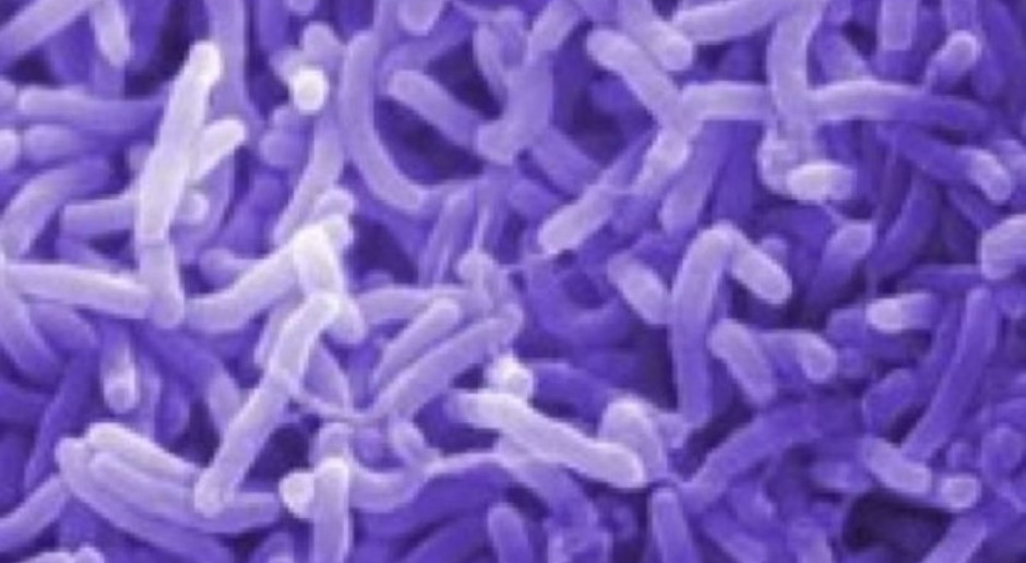 Naukowcy: cholera coraz groźniejsza
