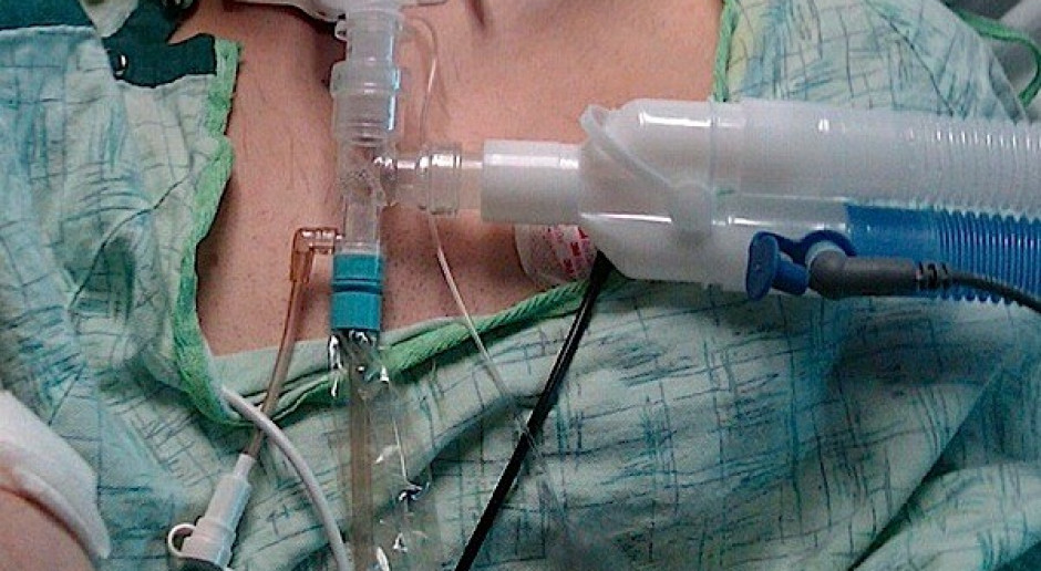 Gliwice: pacjent po rekonstrukcji krtani już mówi i oddycha bez rurki 