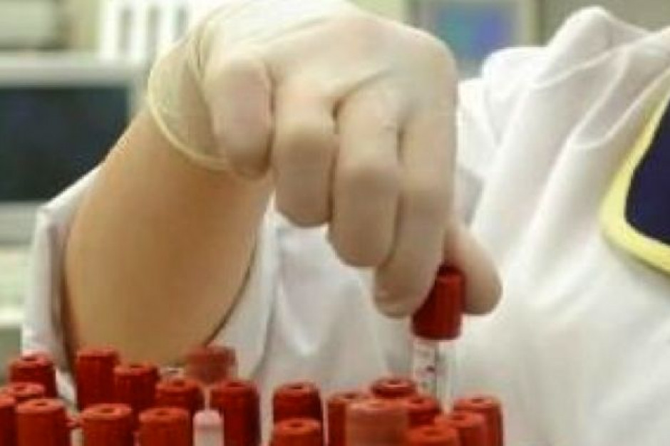 Badania: 72 proc. Polaków nie zna swojego poziomu cholesterolu