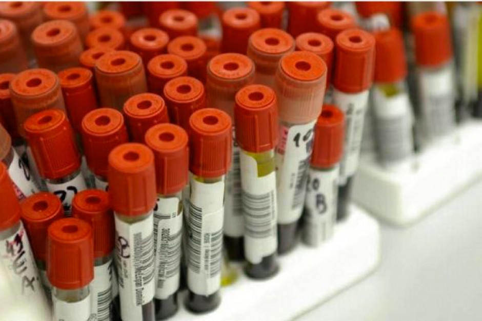 NFZ: szpital musi zapewnić komplet badań pacjentowi