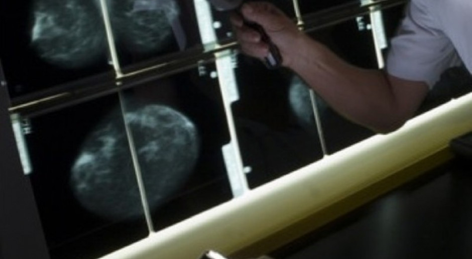 Legnica: nowy mammograf w ośrodku onkologicznym