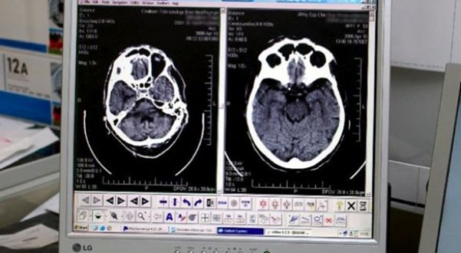 Blachownia: pacjenci szpitala mogą już korzystać z tomografu