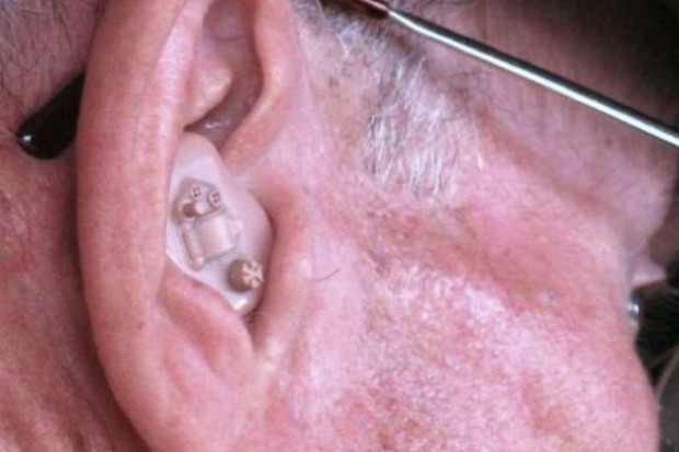 Zadania audiologa i foniatry w wykrywaniu zmian nowotworowych