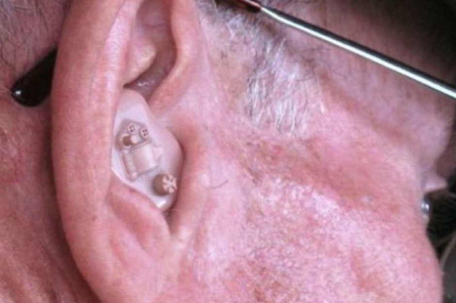 Zadania audiologa i foniatry w wykrywaniu zmian nowotworowych