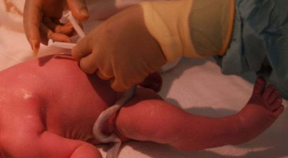 MZ zapowiada: nie będzie resortowych standardów dla porodów niefizjologicznych